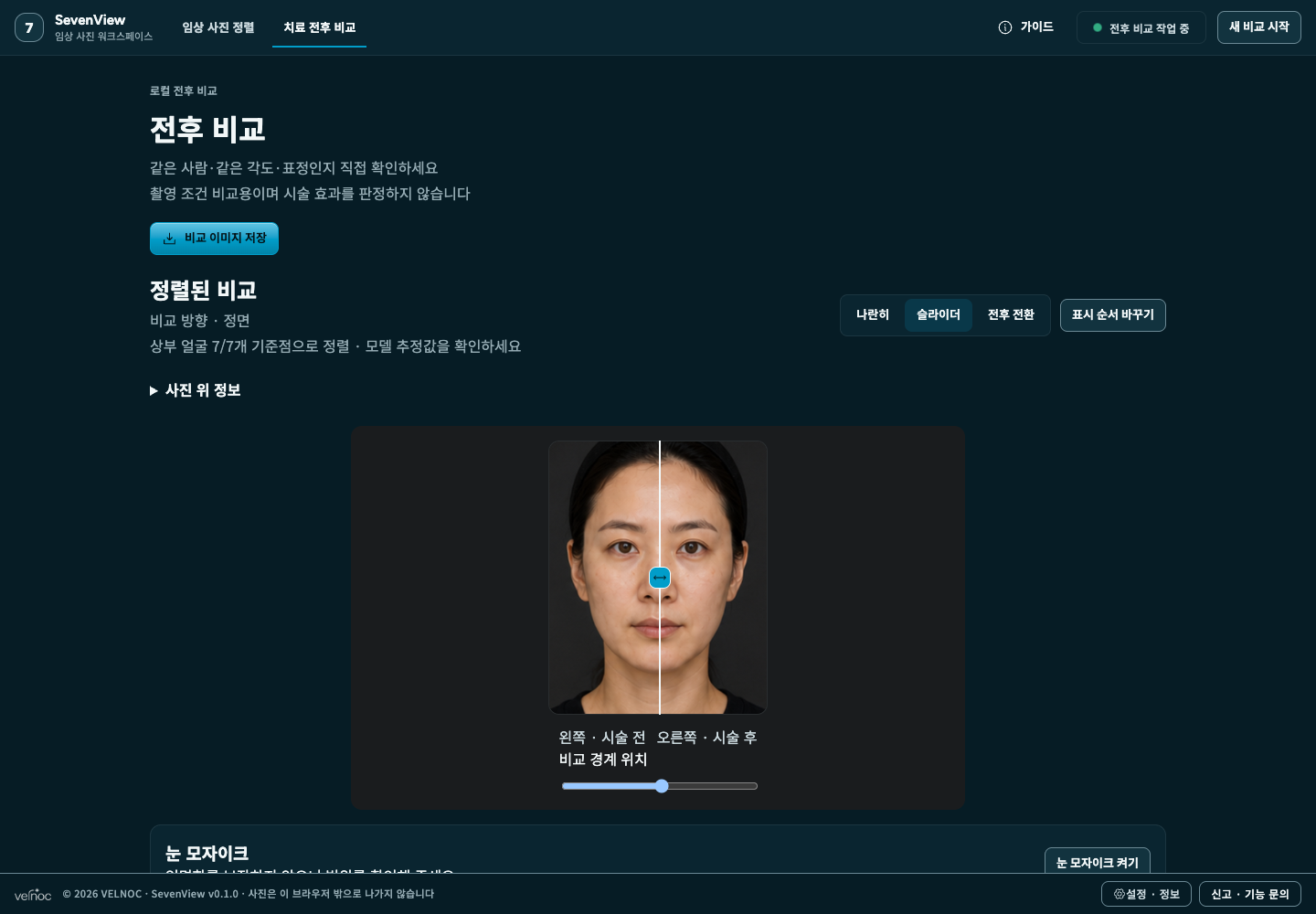 동일한 합성 인물 사진을 슬라이더로 나란히 확인하는 SevenView Community의 시각적 전후 비교 화면